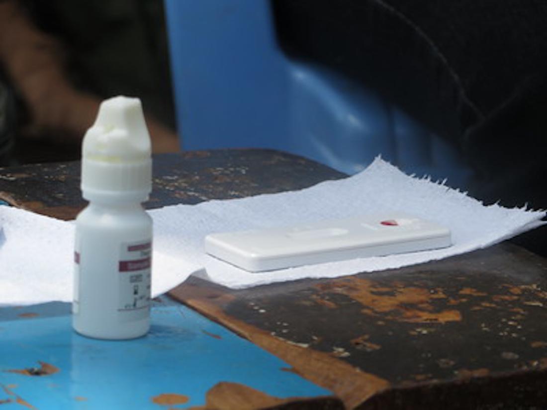 An HIV testing kit.